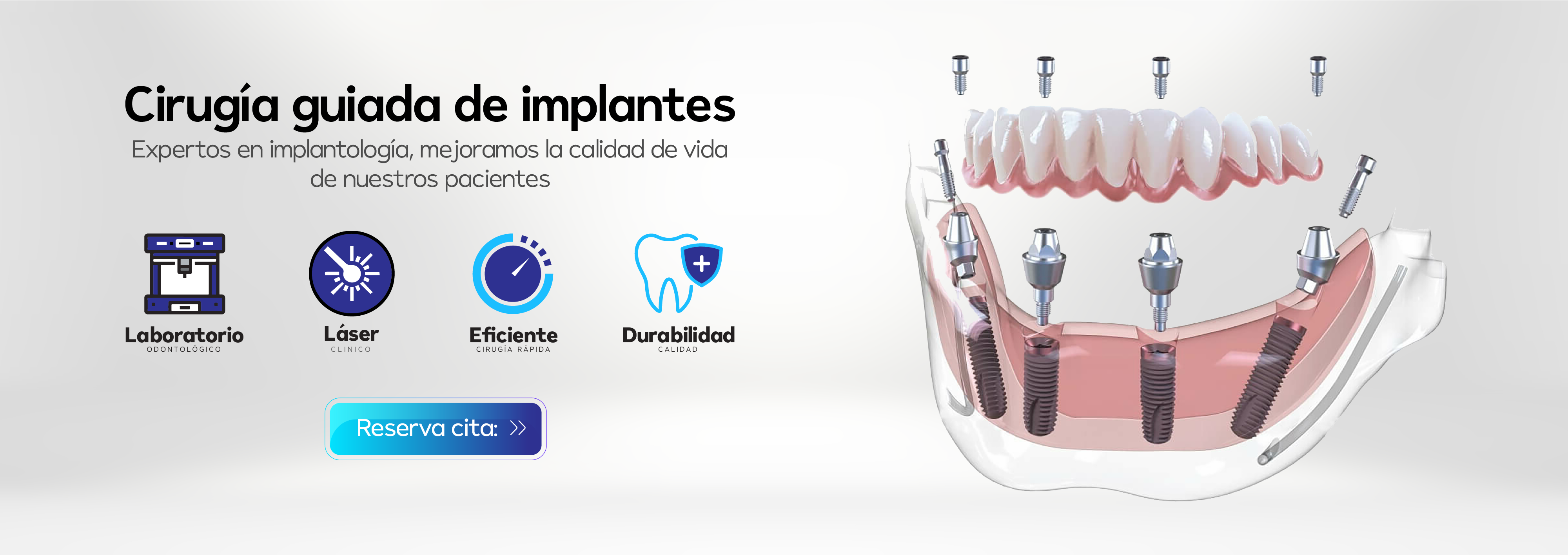 Cirugía Guiada de Implantes Tello Odontología